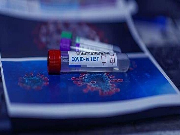 Cierran un laboratorio británico tras hallar unos 43.000 tests de COVID-19 erróneos