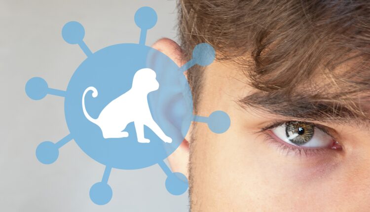 Viruela del mono: ¿qué tan peligrosa es?