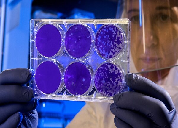 Científicos británicos hallan nueva variante de COVID-19 peor que la delta