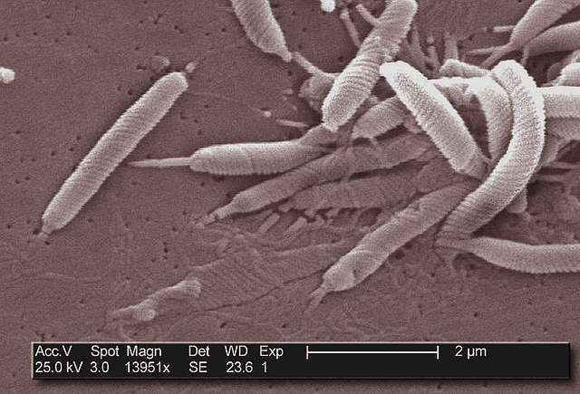 Tres personas mueren tras infectarse con rara bacteria carnívora en Connecticut y Nueva York