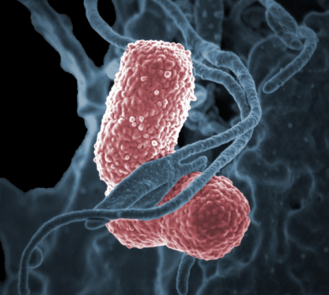 México emite alerta por brote de bacteria Klebsiella